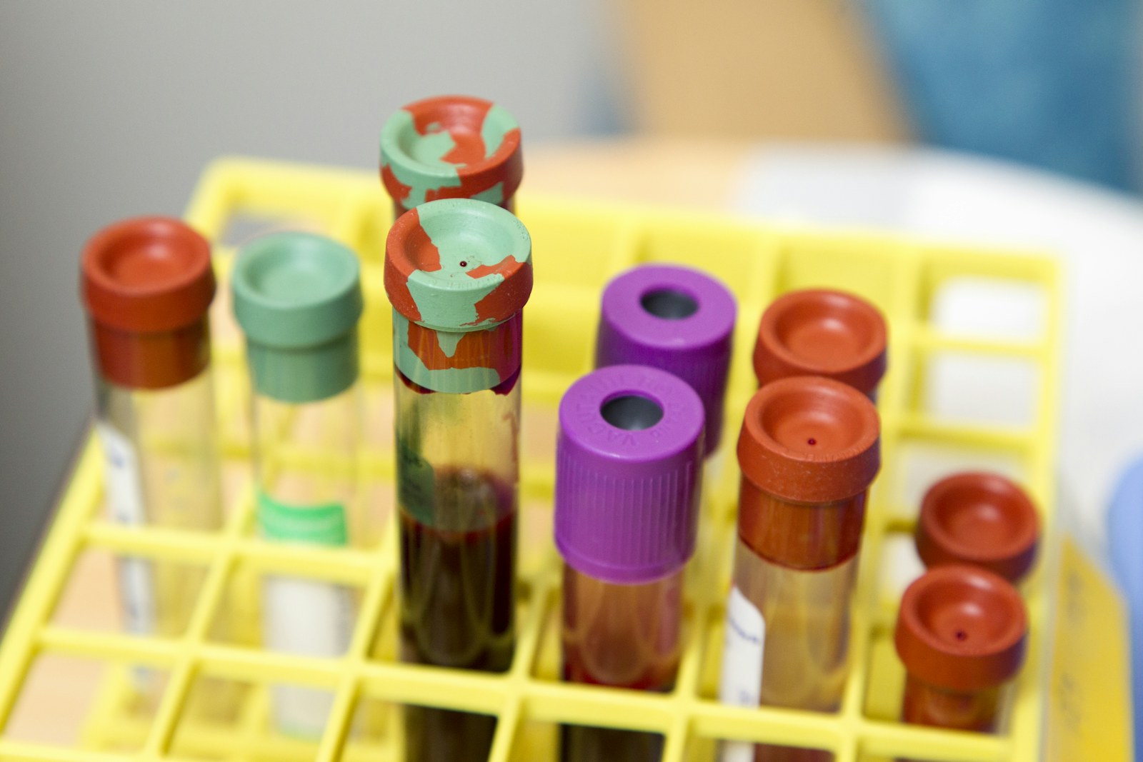 Muestras de laboratorio