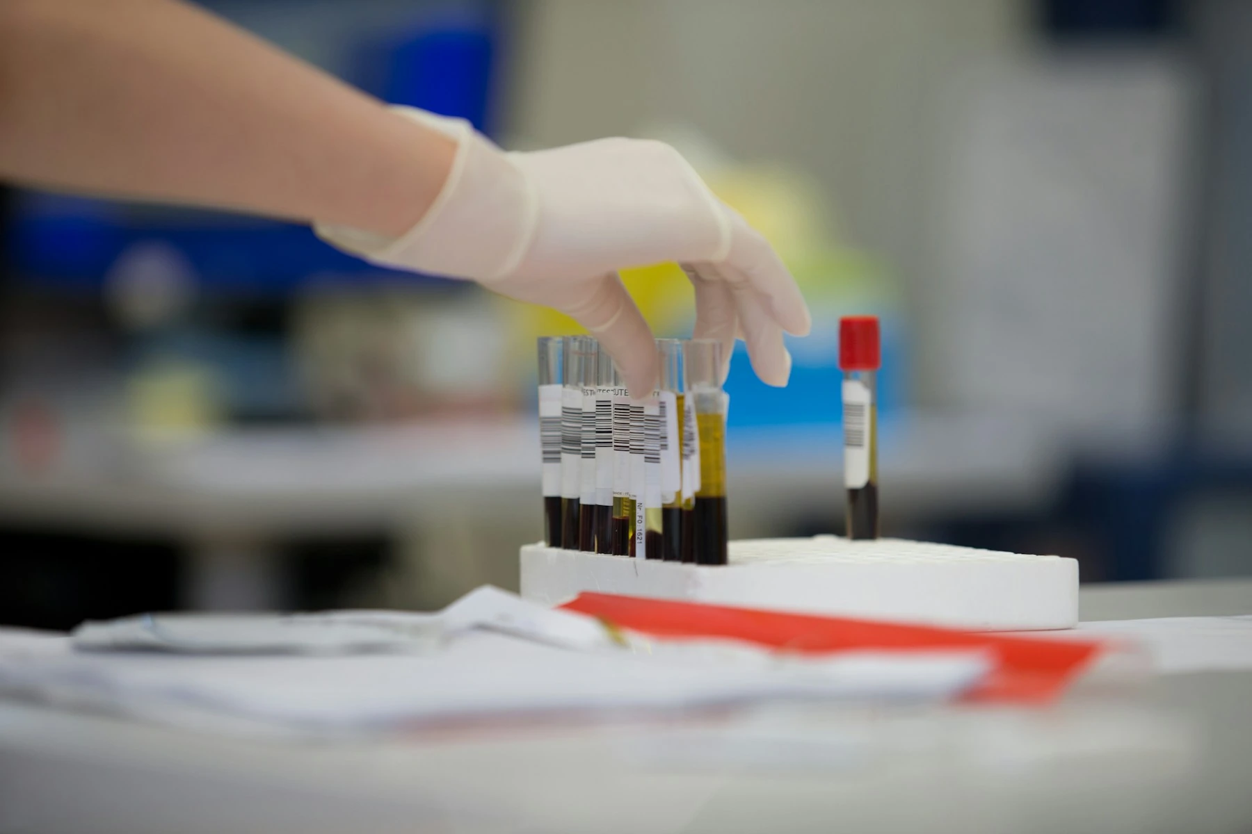 Procesamiento de muestras de sangre en un laboratorio, fotografía ilustrativa