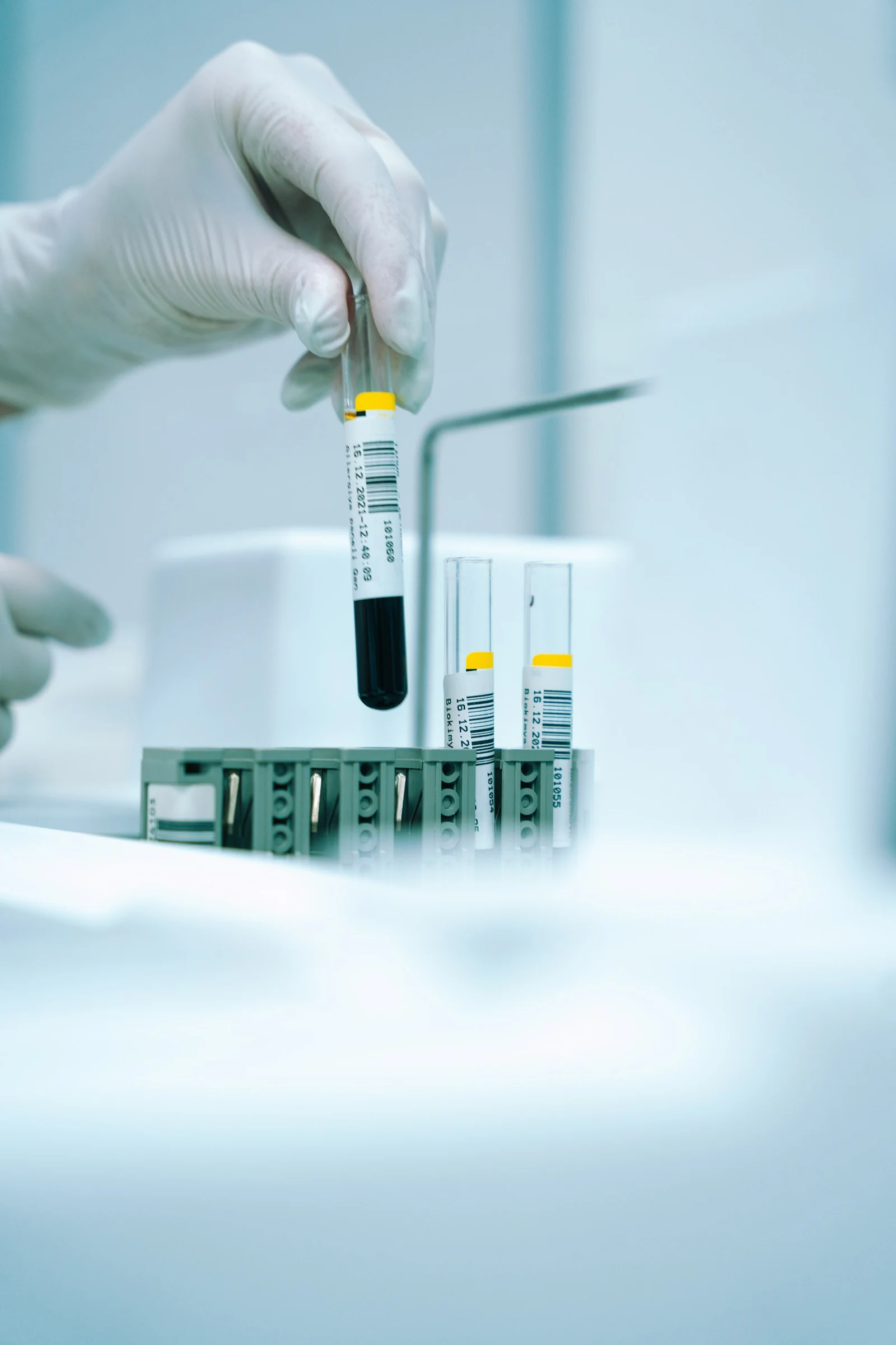 Una mano con guante manipula una muestra de laboratorio